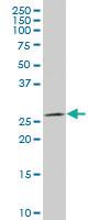 Anti-TNNI3 Mouse Polyclonal Antibody