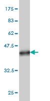 Anti-ART3 Mouse Monoclonal Antibody [clone: 3A2]