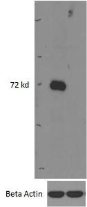 Anti-IRAK3 Antibody (A84545) (0.5 µg/ml) staining of Mouse Bone Marrow (wildtype first lane, KO second lane) lysates (35 µg protein in RIPA buffer). Primary incubation was overnight at 4C Detected with chemiluminescence