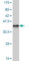 Anti-OLIG1 Mouse Monoclonal Antibody [clone: 3B3]