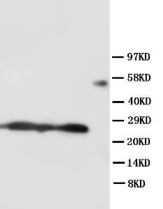 Anti-SFTPA1 Rabbit Polyclonal Antibody