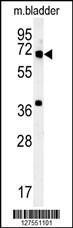 Anti-MET10 Rabbit Polyclonal Antibody (HRP (Horseradish Peroxidase))