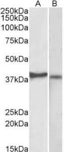 Anti-CX3CR1 Antibody (A82937) (2 µg/ml) staining of Kelly (A) and U251-MG (B) lysates (35 µg protein in RIPA buffer). Primary incubation was 1 hour. Detected by chemiluminescence