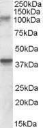 Anti-GRIK3 Antibody (A84546)(0.3µg/ml) staining of Rat Brain lysate (35µg protein in RIPA buffer). Primary incubation was 1 hour. Detected by chemiluminescence.