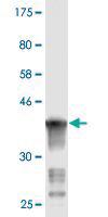 Anti-ART3 Mouse Monoclonal Antibody [clone: 1D2]