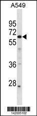 Anti-GPR107 Rabbit Polyclonal Antibody (AP (Alkaline Phosphatase))