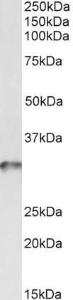 Anti-TPM4 Antibody (A82938) (0.03µg/ml) staining of Human Platelets lysate (35µg protein in RIPA buffer). Primary incubation was 1 hour. Detected by chemiluminescence.