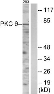 Western blot analysis of lysates from 293 cells using Anti-PKC thet Antibody The right hand lane represents a negative control, where the antibody is blocked by the immunising peptide