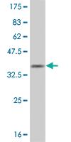 Anti-OLIG1 Mouse Monoclonal Antibody [clone: 2A4]