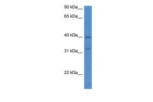 Anti-MTNR1A Rabbit Polyclonal Antibody