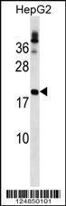 Anti-LHFP Rabbit Polyclonal Antibody (Biotin)