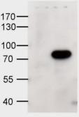 HEK293 overexpressing human ABCD1 and probed with Anti-ABCD1 Antibody (A84547) at 1 µg/ml (mock transfection in first lane)