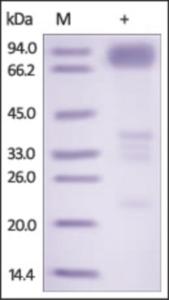 The purity of rh TNFRSF21 /DR6 Fc Chimera was determined by DTT-reduced (+) SDS-PAGE and staining overnight with Coomassie Blue.