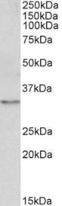 Anti-TPM4 Antibody (A82938) (0.1µg/ml) staining of NIH3T3 lysate (35µg protein in RIPA buffer). Primary incubation was 1 hour. Detected by chemiluminescence.