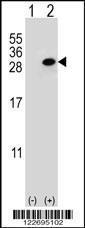 Anti-CLTA Rabbit Polyclonal Antibody (APC (Allophycocyanin))