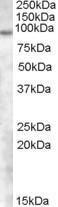 Anti-TCHHL1 antibody