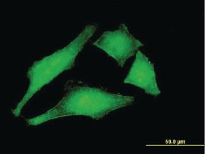 Anti-MCM3AP Mouse Monoclonal Antibody [clone: 1H3]