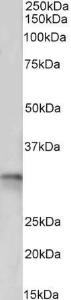 Anti-TPM4 Antibody (A82938) (0.5µg/ml) staining of Pig Heart lysate (35µg protein in RIPA buffer). Primary incubation was 1 hour. Detected by chemiluminescence.