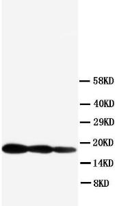 Anti-IL1 beta Rabbit Polyclonal Antibody