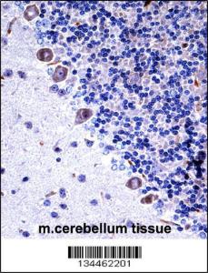 Anti-CSF1R Rabbit Polyclonal Antibody (HRP (Horseradish Peroxidase))