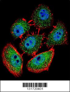 Anti-SPECC1 Rabbit Polyclonal Antibody (HRP (Horseradish Peroxidase))