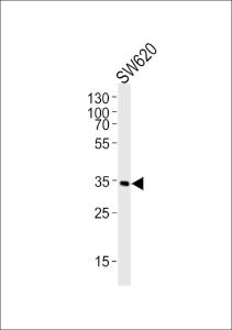 Anti-C1QBP Rabbit Polyclonal Antibody