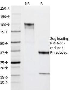 SDS-PAGE analysis of Anti-HLA DRA Antibody [IPO-10] under non-reduced and reduced conditions; showing intact IgG and intact heavy and light chains, respectively SDS-PAGE analysis confirms the integrity and purity of the antibody