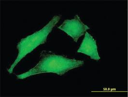 Anti-MCM3AP Mouse Monoclonal Antibody [clone: 1H3]