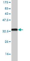 Anti-ZIC4 Mouse Monoclonal Antibody [clone: 4B1]