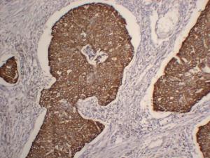 Antibody anti-cytokeratin 5 ABT-CK5