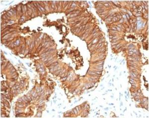 Immunohistochemical analysis of formalin-fixed, paraffin-embedded human colon tissue using Anti-EpCAM Antibody [EGP40/7035R]