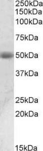 Anti-ACPP Antibody (A82939) (0.01 µg/ml) staining of Human Prostate lysate (35 µg protein in RIPA buffer). Primary incubation was 1 hour. Detected by chemilu minescence