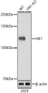 Anti-Hexokinase 1 Rabbit Monoclonal Antibody [clone: ARC0256]