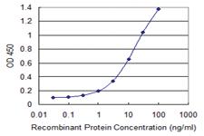 Anti-MCM3AP Mouse Monoclonal Antibody [clone: 1H3]