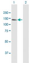 Anti-CEMIP Rabbit Polyclonal Antibody