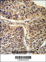 Anti-T-complex Protein 1 Subunit gamma Rabbit Polyclonal Antibody (AP (Alkaline Phosphatase))