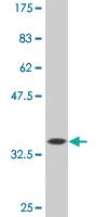 Anti-TBX2 Mouse Monoclonal Antibody [clone: 3B2]