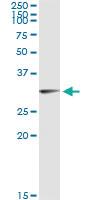 Anti-OLIG1 Antibody Pair