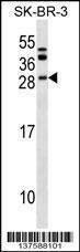 Anti-BCL7C Rabbit Polyclonal Antibody (HRP (Horseradish Peroxidase))