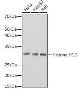 Western blot analysis of extracts of various cell lines, using Anti-Histone H1.2 Antibody [ARC1836] (A307750) at 1:3,000 dilution. The secondary Antibody was Goat Anti-Rabbit IgG H&L Antibody (HRP) at 1:10000 dilution. Lysates/proteins were present at 25 µg per lane