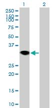 Anti-RNF144A Mouse Polyclonal Antibody