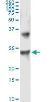 Anti-UBE2T Antibody Pair