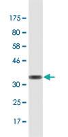 Anti-EBF4 Mouse Monoclonal Antibody [clone: 4E10]