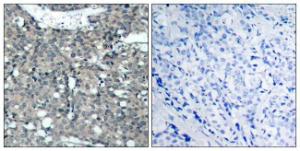 Antibody anti-paxillin A95328-100 100 µg