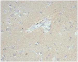 Immunohistochemical analysis of formalin-fixed, paraffin-embedded human brain tissue using Anti-EpCAM Antibody [EGP40/7035R]