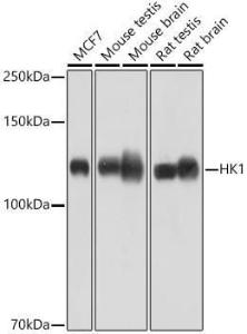 Anti-Hexokinase 1 Rabbit Monoclonal Antibody [clone: ARC0256]