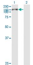 Anti-CEMIP Mouse Monoclonal Antibody [clone: 3C12]