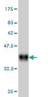 Anti-ADCYAP1R1 Mouse Monoclonal Antibody [clone: 2B12]