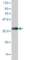 Anti-ZIC4 Mouse Monoclonal Antibody [clone: 1A9]