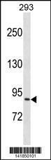 Anti-NCBP1 Rabbit Polyclonal Antibody (AP (Alkaline Phosphatase))